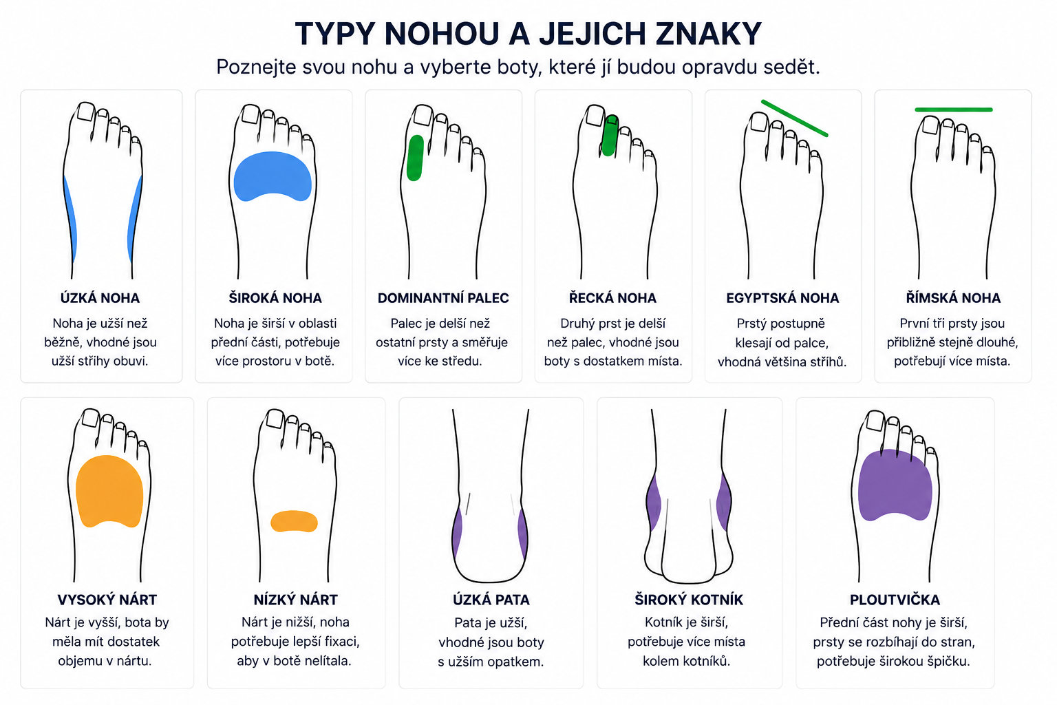 Vizuální atlas dětských nohou – nejčastější typy dětských chodidel a jejich kombinace. 